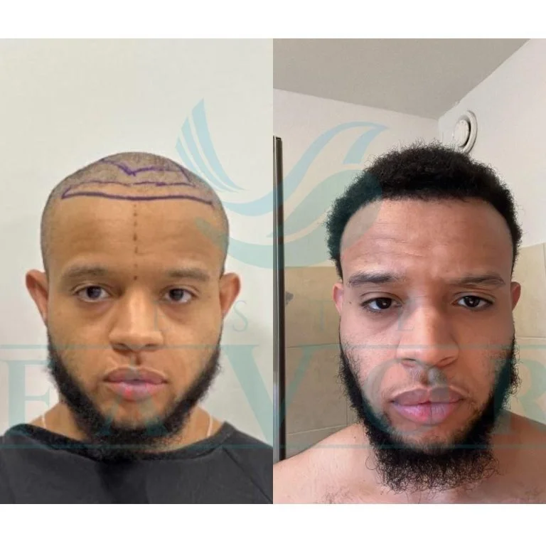 Peinados Norwood 3: 12 Estilos Que Funcionan