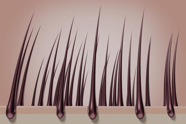 Revisión de folículos FUE bajo microscopio en clínica capilar España.